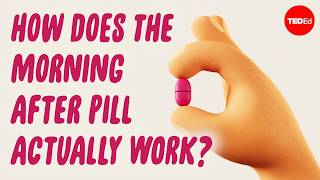 How does the morning-after pill prevent pregnancy? - Alison Edelman thumbnail