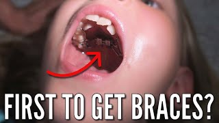 Finally, Someone is Getting Braces...and Separators, and an Expander! | Who Is the Lucky One?? thumbnail